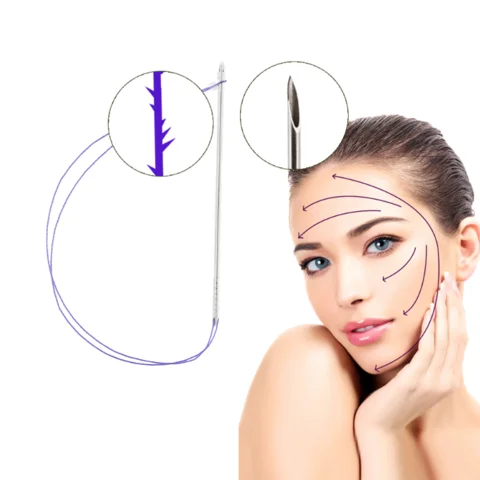 Pdo Thread Lift Korea V Lifting Nose Mono 3d 4d 6d Face Lifting Thread Pdo Plla Pcl Cog Threads