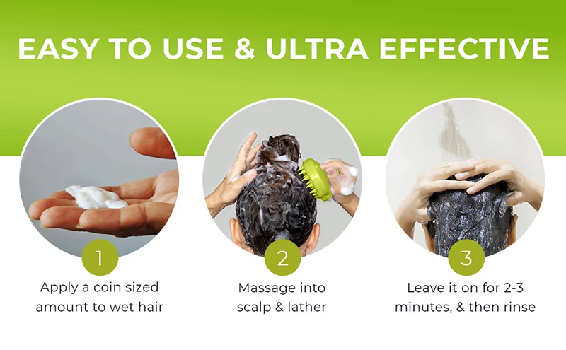 Relieve Itchy Dry Scalp and Treat Dandruff Seborrheic Dermatitis Psoriasis with Anti-Folliculitis Hair Growth Shampoo