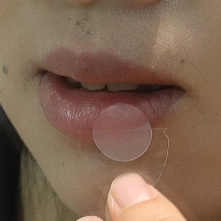 Trummed Cold Sore Patch Hydrocolloid Herpes Patch for Soothing & Hiding Cold Sores