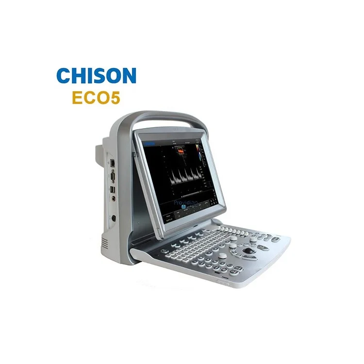 Медицинский портативный ультразвуковой допплер Chison eco 5