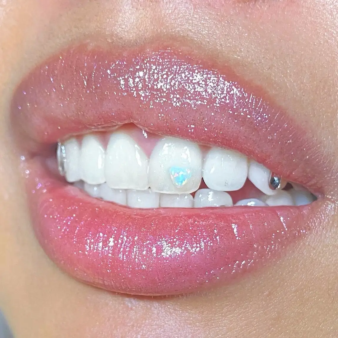 Wholesale Dental Butterfly Teeth Gems Horse Eye Round Shape Blue Green Opal Tooth Gems