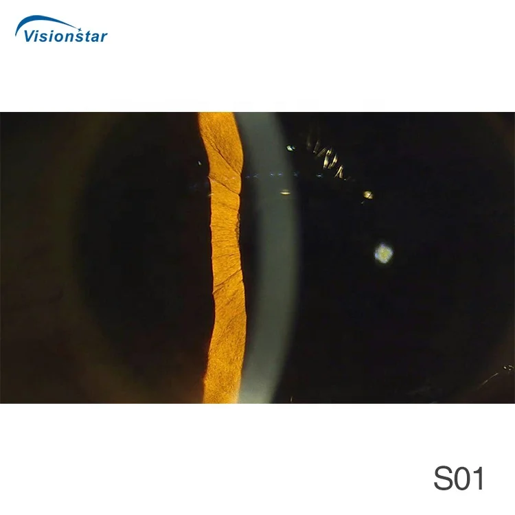 VSO-600 New Model Digital Portable Slit Lamp