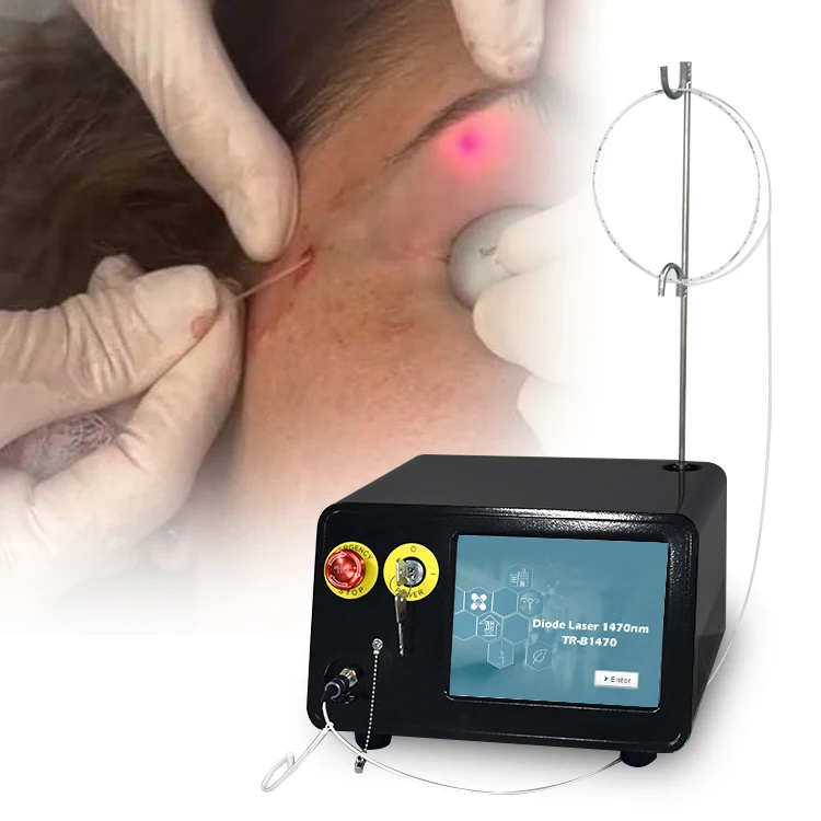 TRIANGELASER subdermico endolaser diodo 1470 fibra machine fiber optic lifting clinic use device