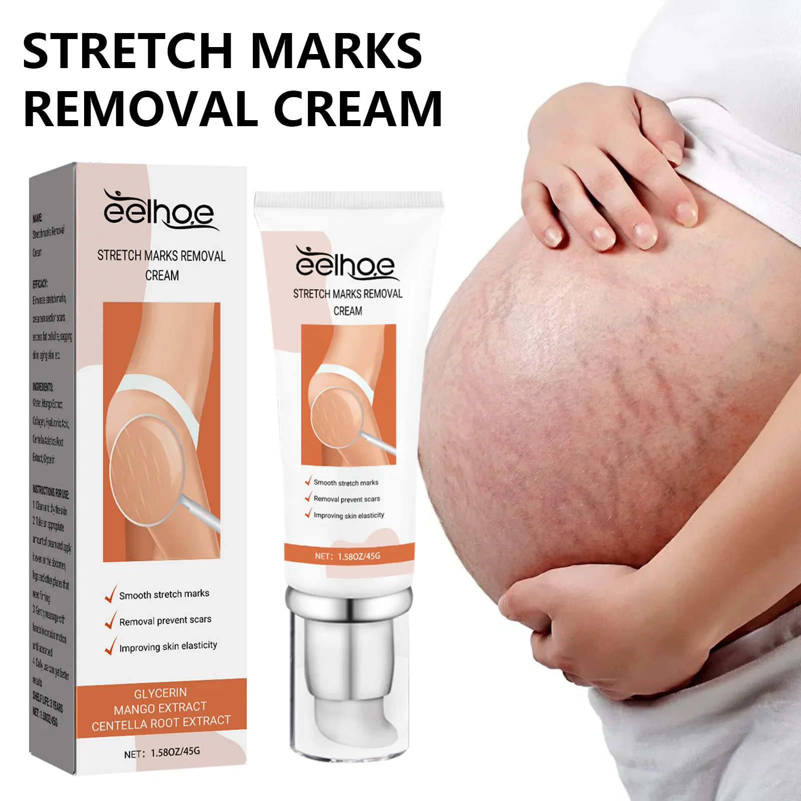 wholesale postpartum stretch mark cream abdomen thighs leg buttocks chest pregnancy stretch mark removal cream for female
