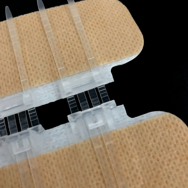 
Devices for wound closure zip skin closure zipstitch 