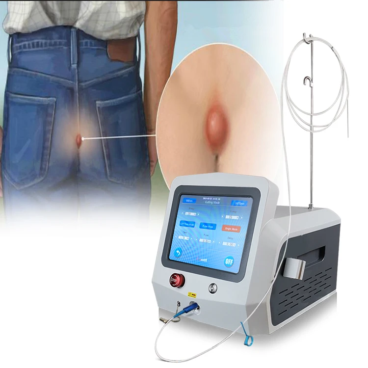 980nm 1470nm anal manometry laser proctology laser for hemorrhoids
