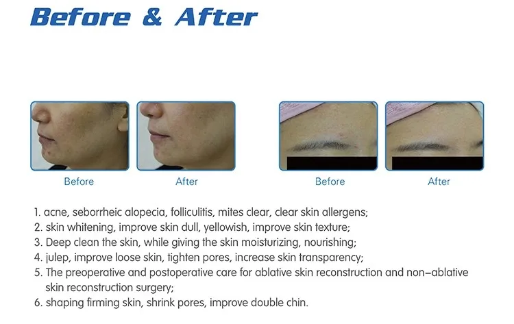 High quality hydro facials machine with led mask H2O2 hidro hydrofacials machine hydro facial machine