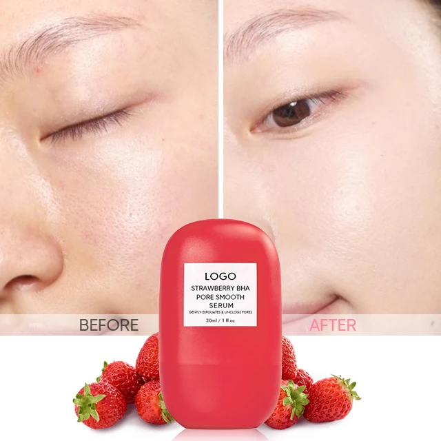 Organic Natural Pore Treatment Strawberry Enzyme Visibly Minimize 30ml Face Bha Facial Serum For Sensitive Skin