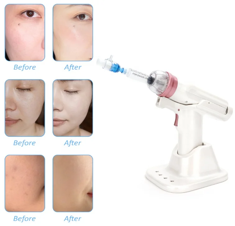 YanYi EZ meso injector mesotherapy pen