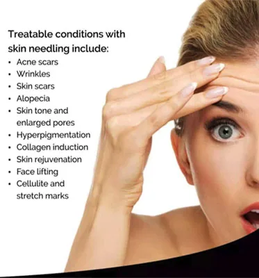 YanYi Anti Aging Dr pen M8 Ultima Derma Pen