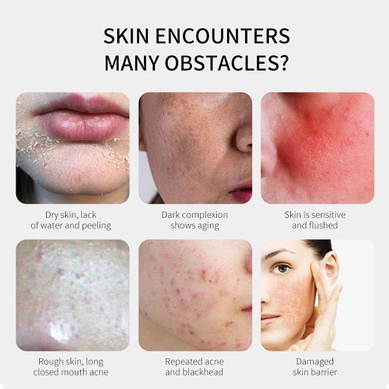 Natural Whitening Moisturizing Kiwi Rose Petal Jellymask Jelly Powder Hydro Mask Facial Mask