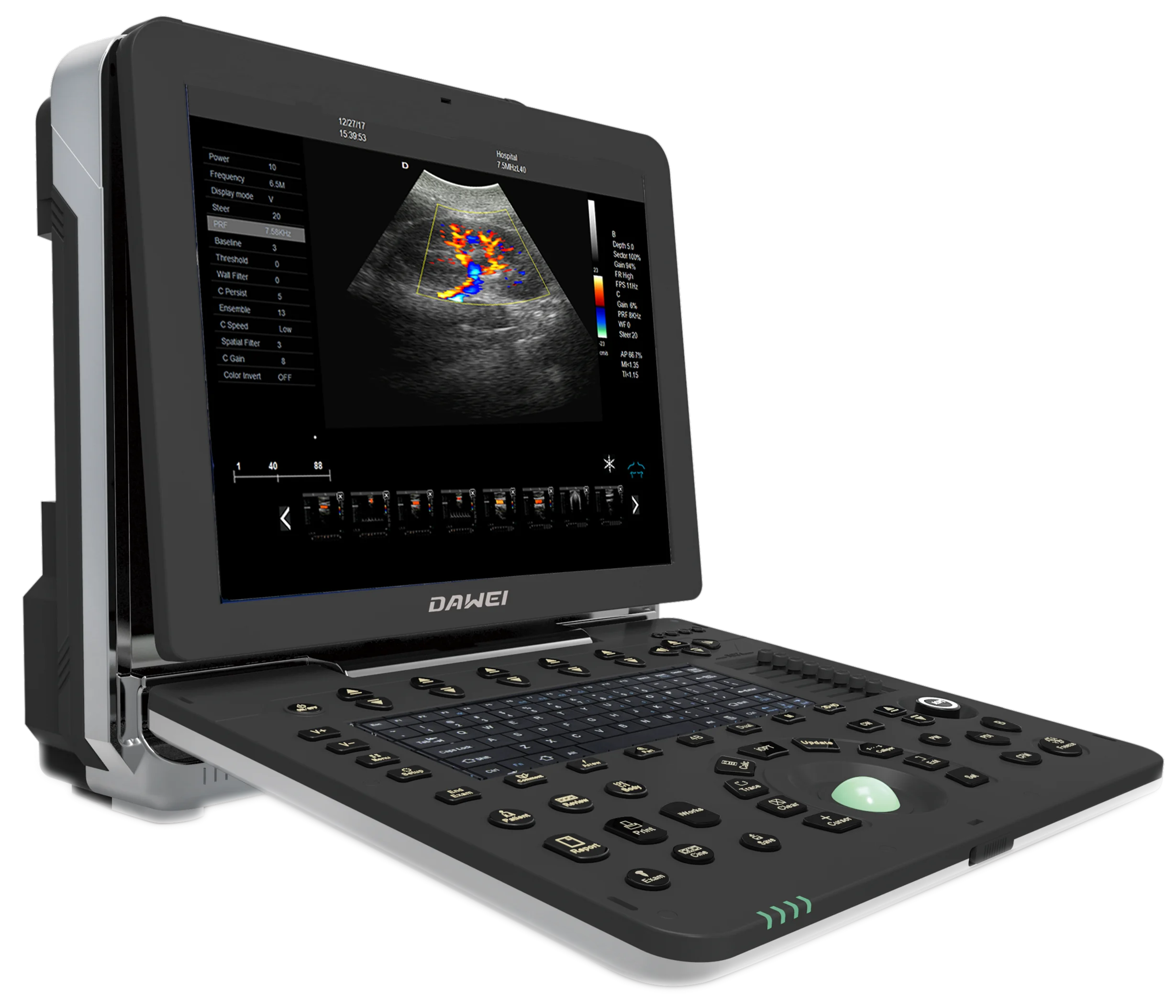 DW-P5 portable color doppler ultrasonic machines