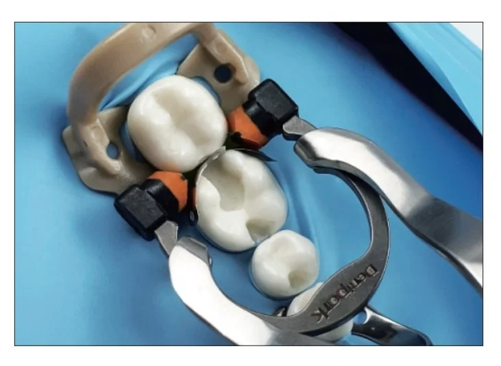 NEW TYPE Dental Tools Autoclavable Matrix Clip Dental NITI Clamps Separating Ring