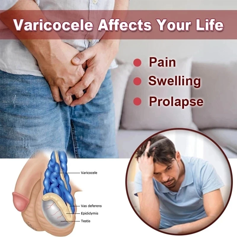 OEM Genital Scrotum Varicocele Varicose Veins Cream Varicosity Angiitis Phlebitis Leg Veins Pain Ointment