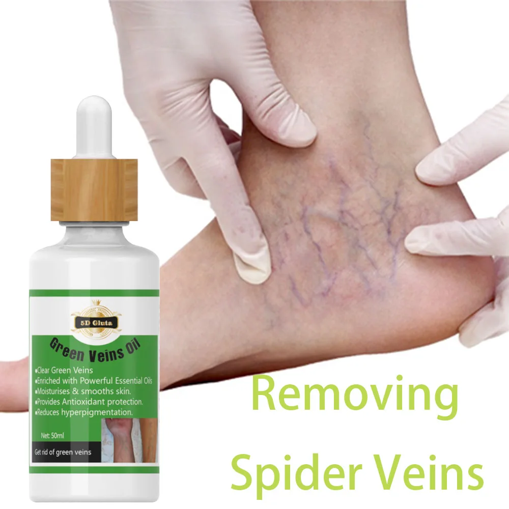 OEM Private Label Logo 5D Gluta Green Veins Oil Removing Spider Veins Mixed with Body Milk Lotion