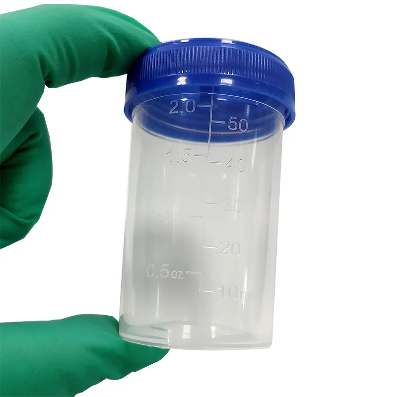Одноразовый пластиковый образец для медицинского пациента, коллекция образцов для мочи 60 мл, чашка для образцов