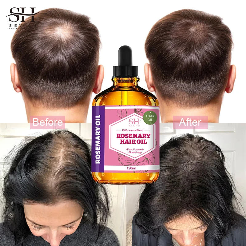 Private Label Organic Rose Rosemary Oil Intensely Nourishing Hair Oil Recovery Hair Damaged For Short Long Hair