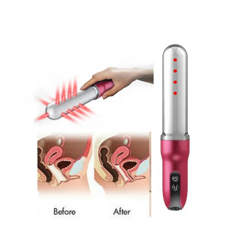 Female Health Vaginal Electrode Tightening Device Vibrator Soft Cold Laser Vagina Physical Therapy Equipment