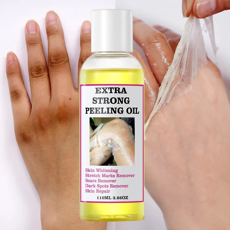 Top selling whitening skin peeling lotion skin lightening knuckle dark spot removal orange peeling lotion