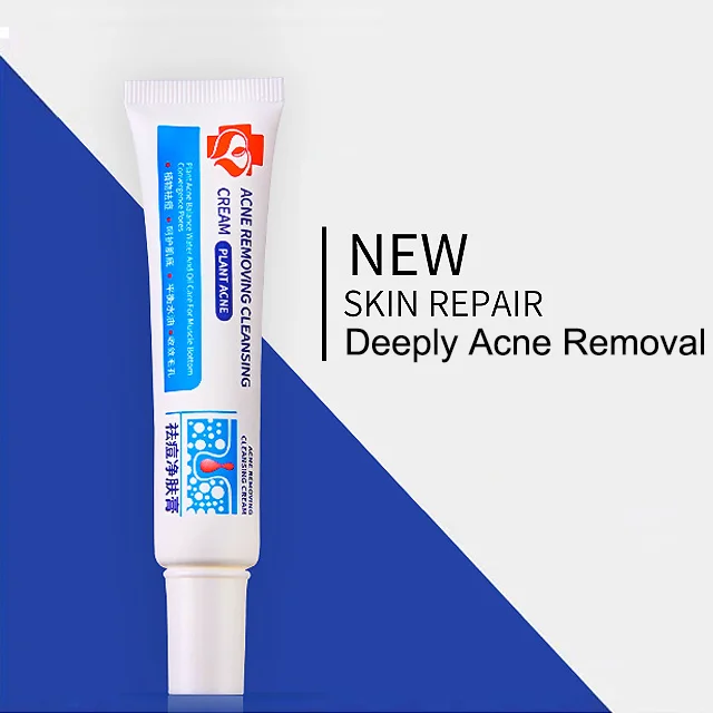 Effective Herbal Shrink Pores Moisturizing Whitening Remove Pimple Cream Face Anti Acne Removal Cream