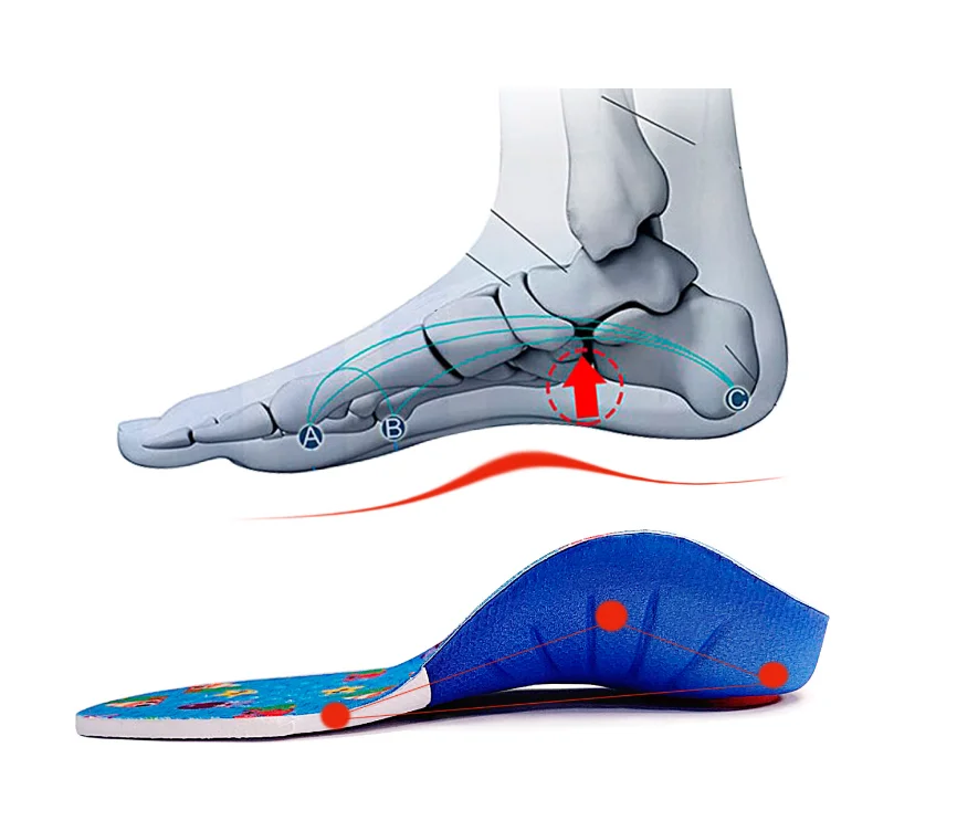 Kids Orthopedic Insole Professional Arch Support Flat Foot OX-Legs Kids Orthotic Shoe Soles Insert