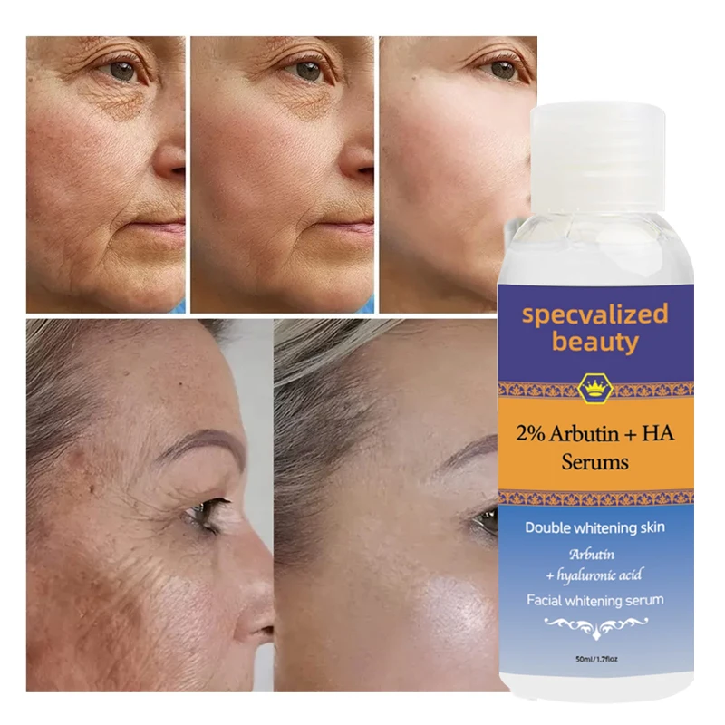 Our own brand can be easily customized. Alpha Arbutin 2% + HA serum can improve uneven skin tone and pigmentation.