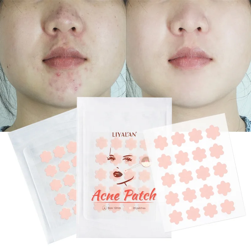 Private Label Skincare Hydrocolloid Acne Plaster Remove Acne Spot Pimple Master Acne Patch