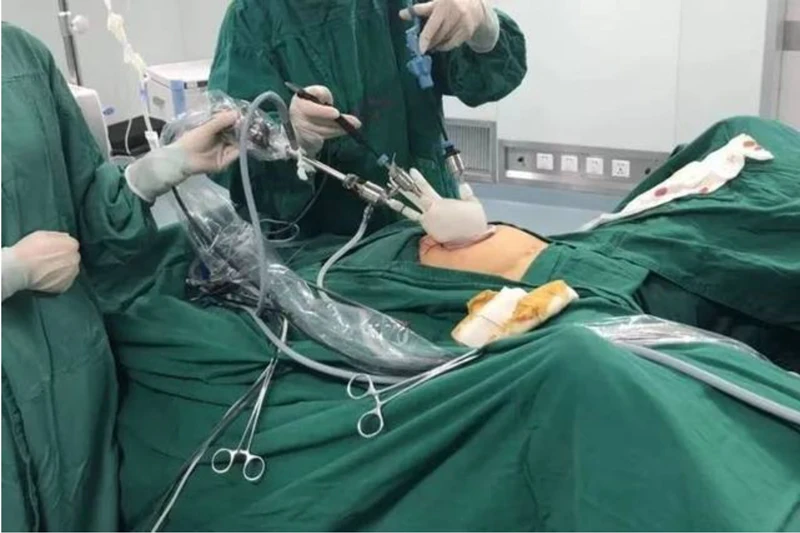 Single Use Transparent Color  Endoscope Laparoscopic Camera Cover