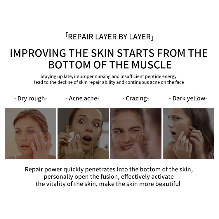 Private Label Custom Logo Korea Organic Facial Skincare Products Moisturizing Brightening Face Cosmetics Tea Tree Skin Care Set