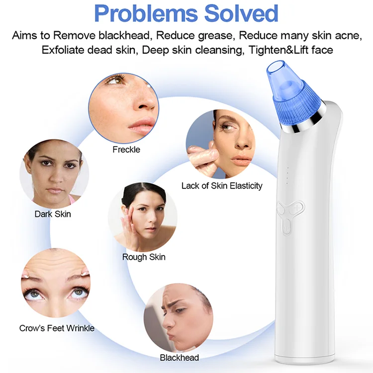 Universal USB Rechargeable Blackhead Remover Vacuum For Skin Care