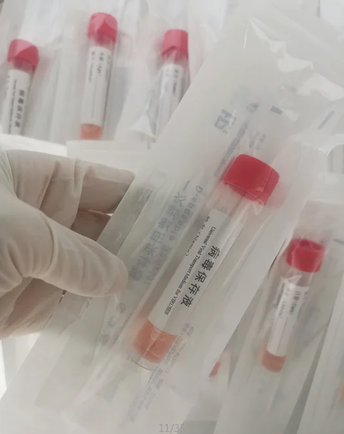 
China Supplies Personal Genetic Analysis Dna Testing Ancestry Dna Test Sampling Flocked Swab Home Dna Testing Kit 