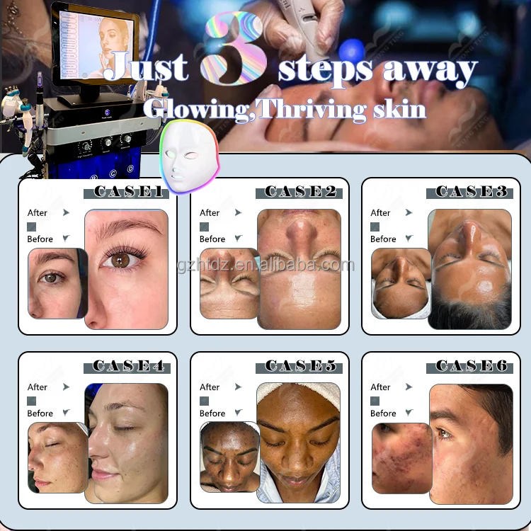 new pattern professional beauty clinic face cleaning machine 15 In 1 Machine device equipment 2024