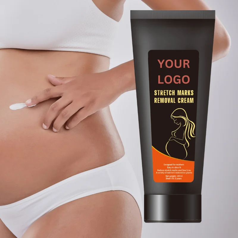 Private Label Best stretch mark  cream Oil That Removes Stretch Marks Cream For Moms