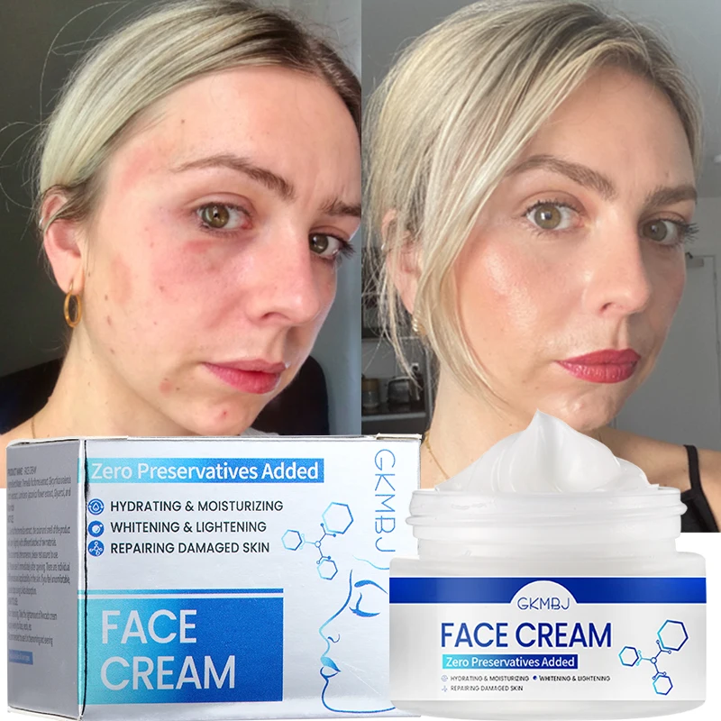 microbial ferment skin care,dark spot acne swelling remove,hydrolyzed collagen anti age wrinkle whitening repairing face cream 8
