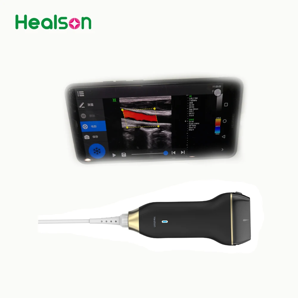  Самый дешевый USB микро ручной цветной допплер Healson C30L ультразвуковая система/машина/устройство/сканер