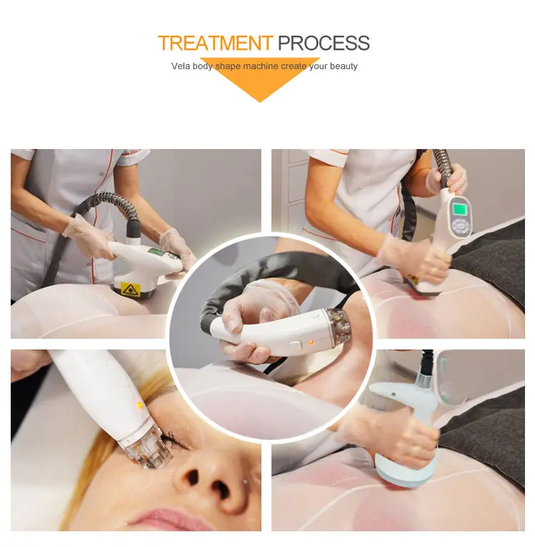 hks-25 vela body shape (5)