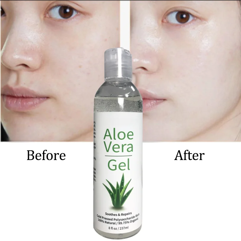 private label wholesale Korean bulk raw natural 100 pure soothing cooling aloe vera gel after sun for face skin in Thailand