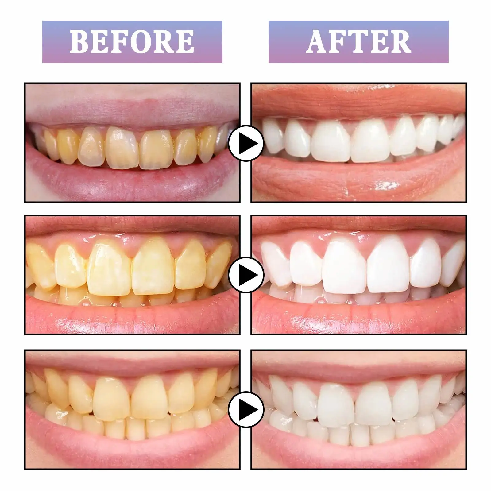 EELHOE Wholesale OEM 4Ml Tooth Paint Pen Teeth Whitening Toothpaste Oral Health Care Teeth Cleaning Essence Oral Stain Remover