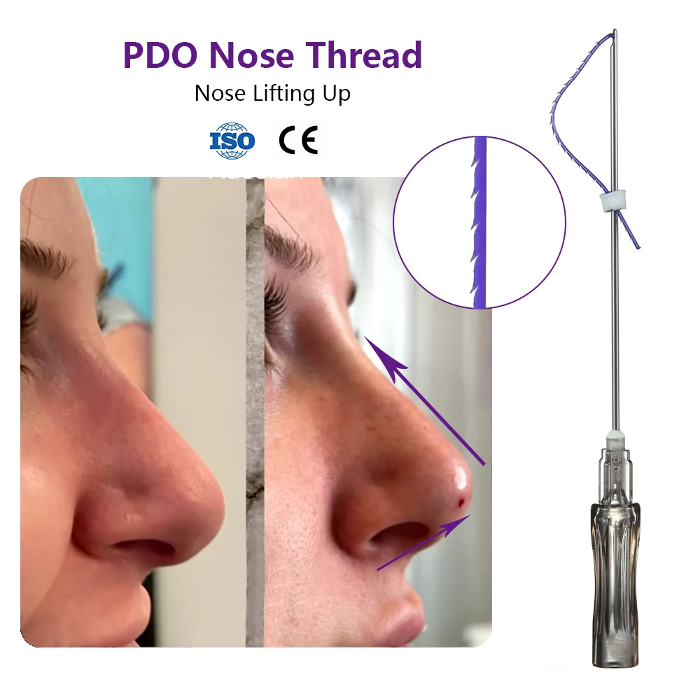 Medical Clinic 21g 60mm Hilos Barbed Tensores Wires Pdo Lift Nose Thread Cog