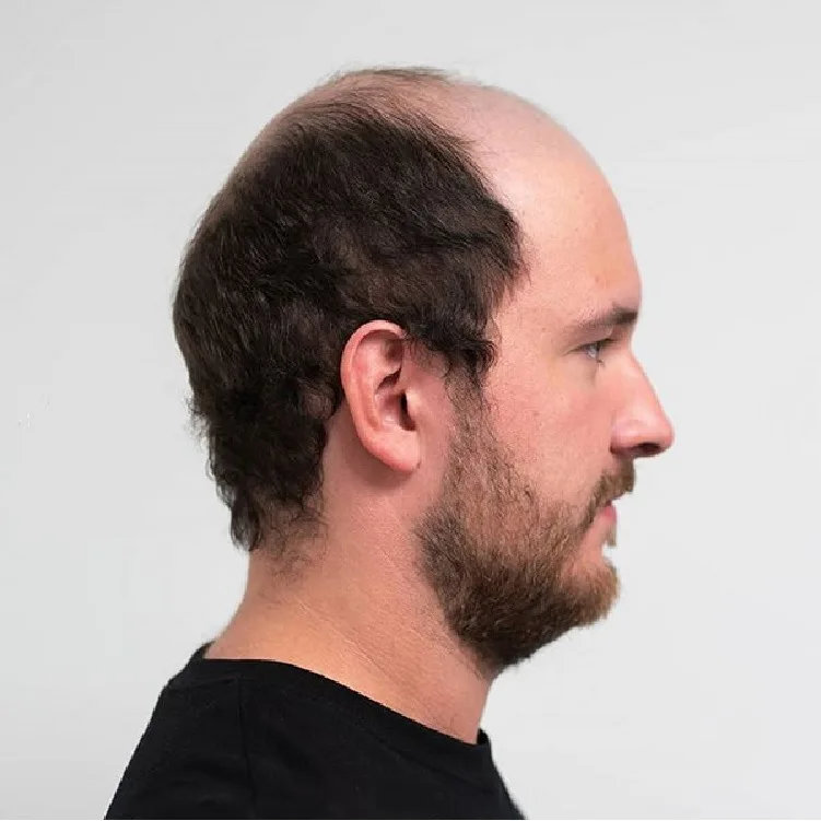 
Customized man brazilian hair toupee hd lace mens toupee pu wig human hair replacement systems toupee for men 