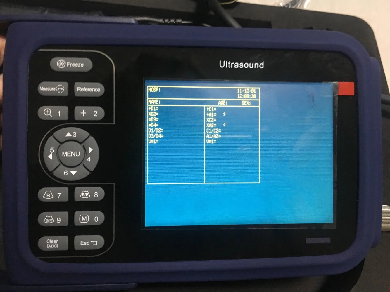  Китайская медицинская портативная SUN-808F домашняя детская ультразвуковая машина для беременности