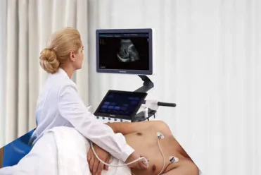 sonoscape p50 elite sonography ultrasound echo machine hospital medical ultrasound instruments