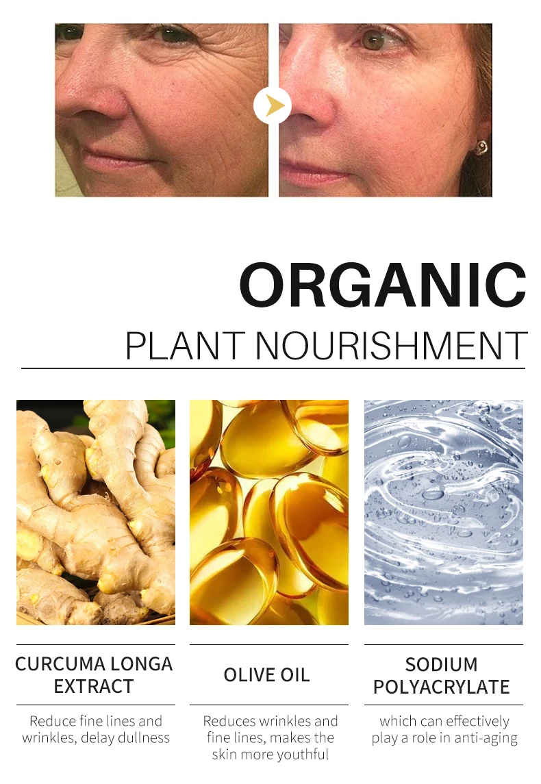 Facial Turmeric Skin Care Brightens Anti-Acne Dark Spots Removal Serum Turmeric Root Extract Turmeric Serum