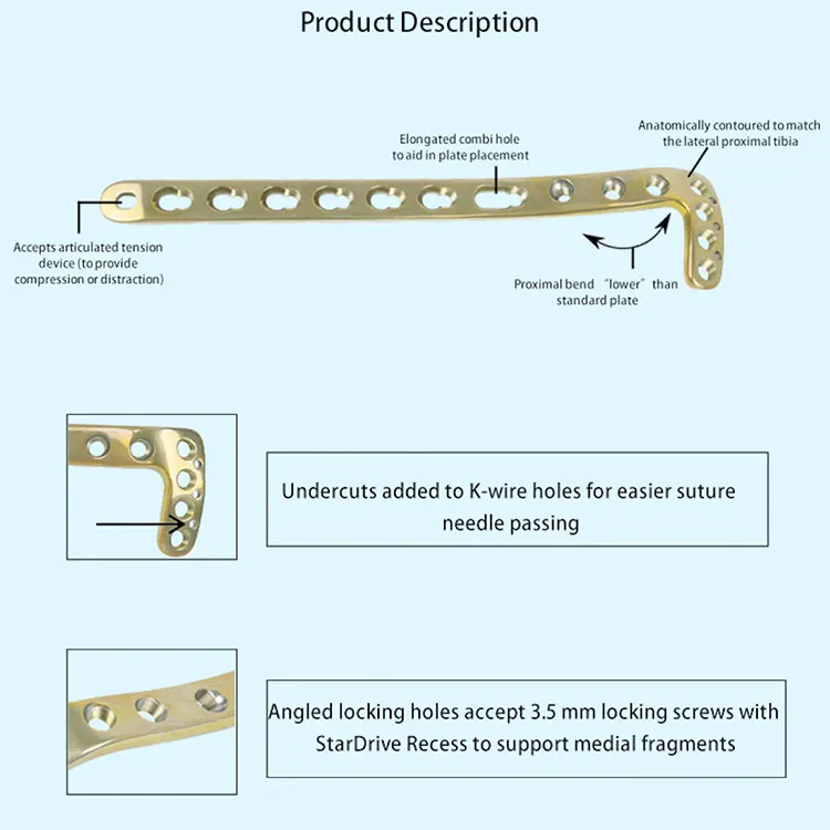 Discounted Price Orthopedic Implants LCP Variable Angle Distal Radius Locking Plate Titanium