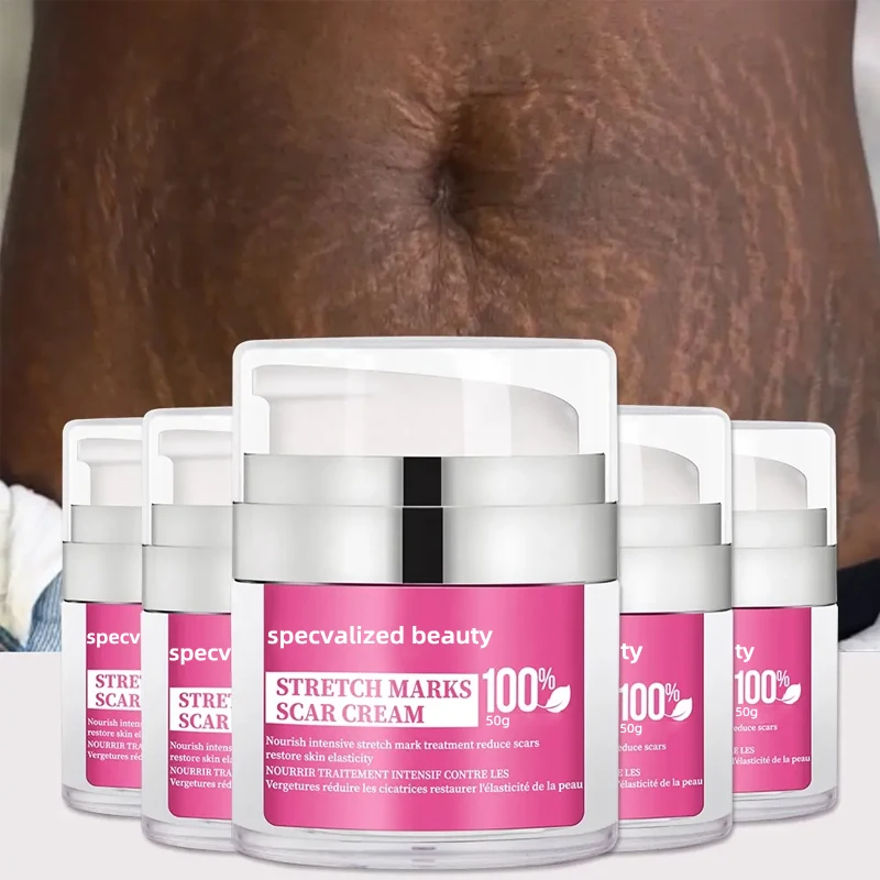 Stretch Mark Care Body Cream Black Skin Vegan Natural Collagen Strong Tummy Inner Thighs Arms Stretch Marks Removal Lotion