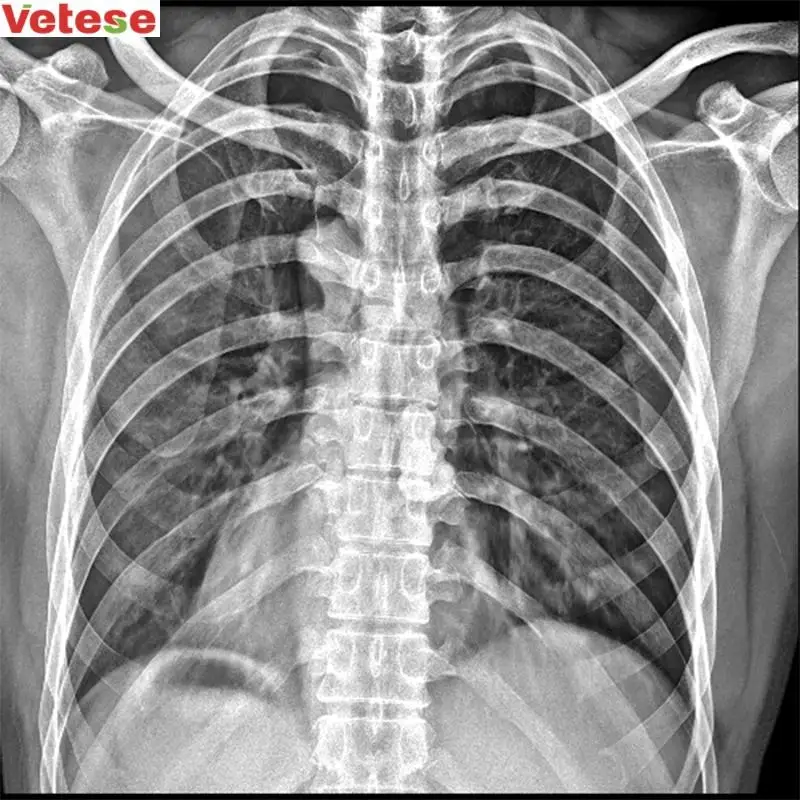 portable x-ray machine price 5KW digital xray 100mA mobile x ray