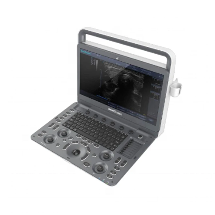 Medical Ultrasound Instruments Sonoscape E2 ultrasound With Competitive Price