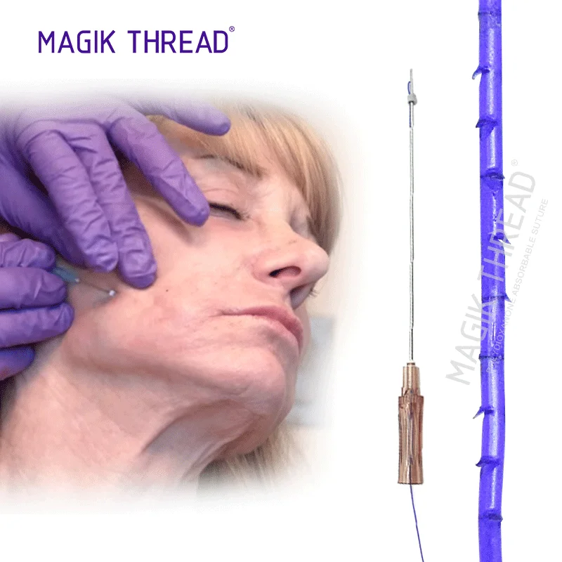Magik Thread Facial beauty V line tensioning threads face lift pdo thread 3d 4d 6d cog sharp