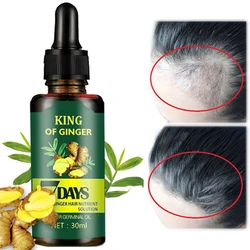 OEM&ODM Factory Best Hair Growth Oil For Baldness Scalp Repair Free Sample