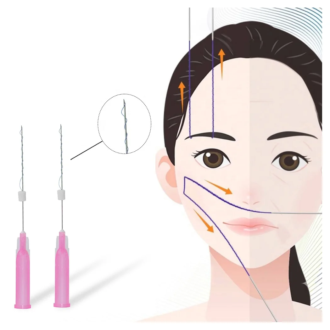 Резьба 4d Cog Pdo Fox Eyes Facelift использует впитываемую моно-винтовую резьбу Pcl